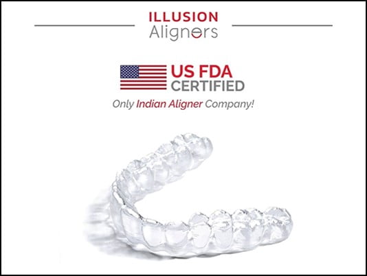 Invisalign Clear Aligners