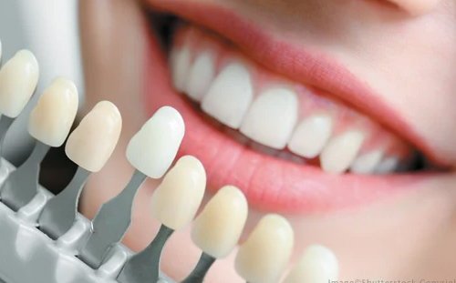 service-img5 Cosmetic Dentistry in kolkata