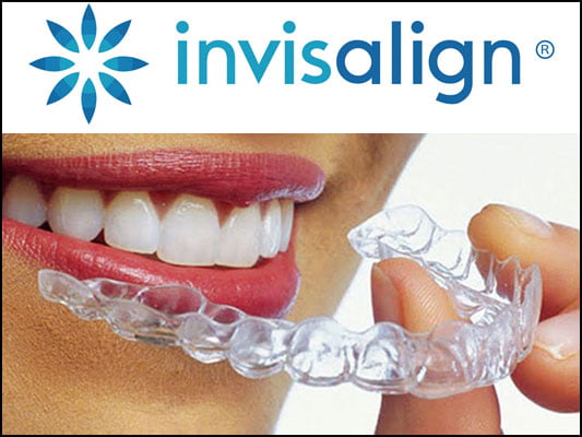 Invisalign Clear Aligner