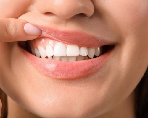 Gum Reshaping