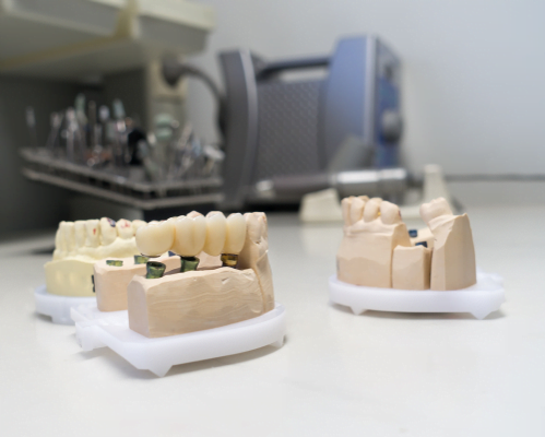 Zirconia Crown