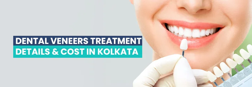 Dental Veneers Treatment Dental Veneers Treatment