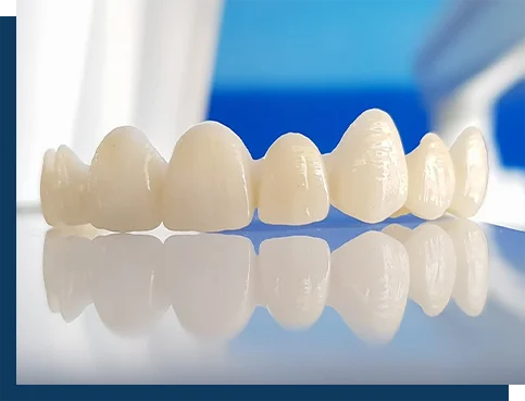 img5 Zirconia Crowns