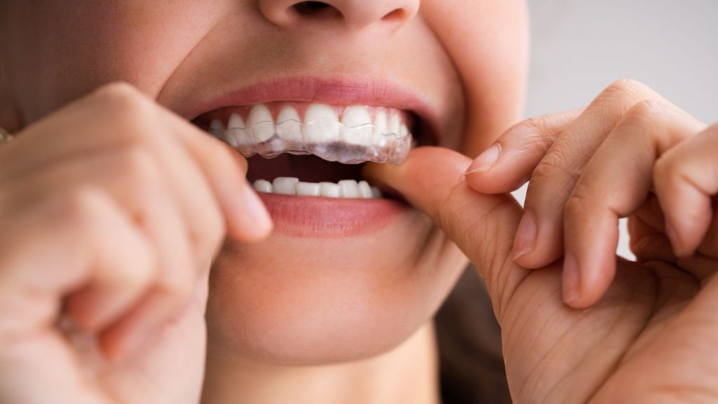 Night Guards for TMJ Disorder Night Guards for TMJ Disorder