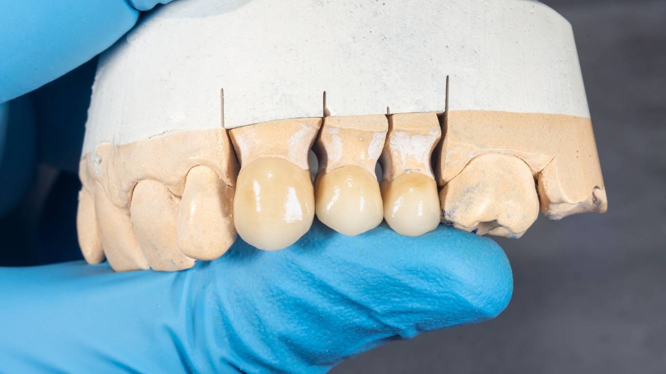 Zirconium Crowns Zirconium Crowns