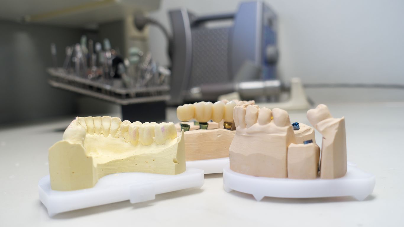 Types of Zirconia Crowns Types of Zirconia Crowns