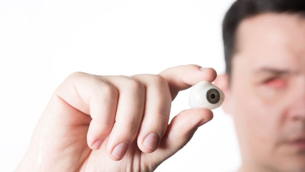 Orbital Prostheses Orbital Prostheses