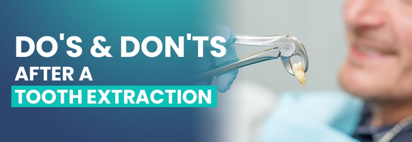 Dos & Don’ts After a Tooth Extraction