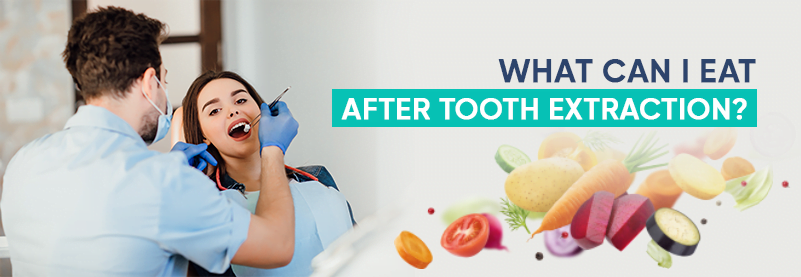 what to eat after tooth extraction blog banner